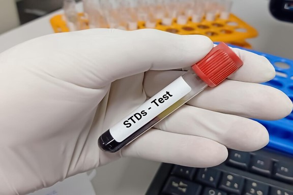 std-screening-test